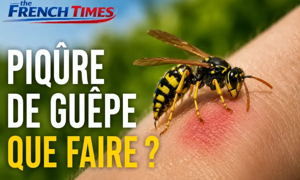 Piqure de Guepe Que Faire